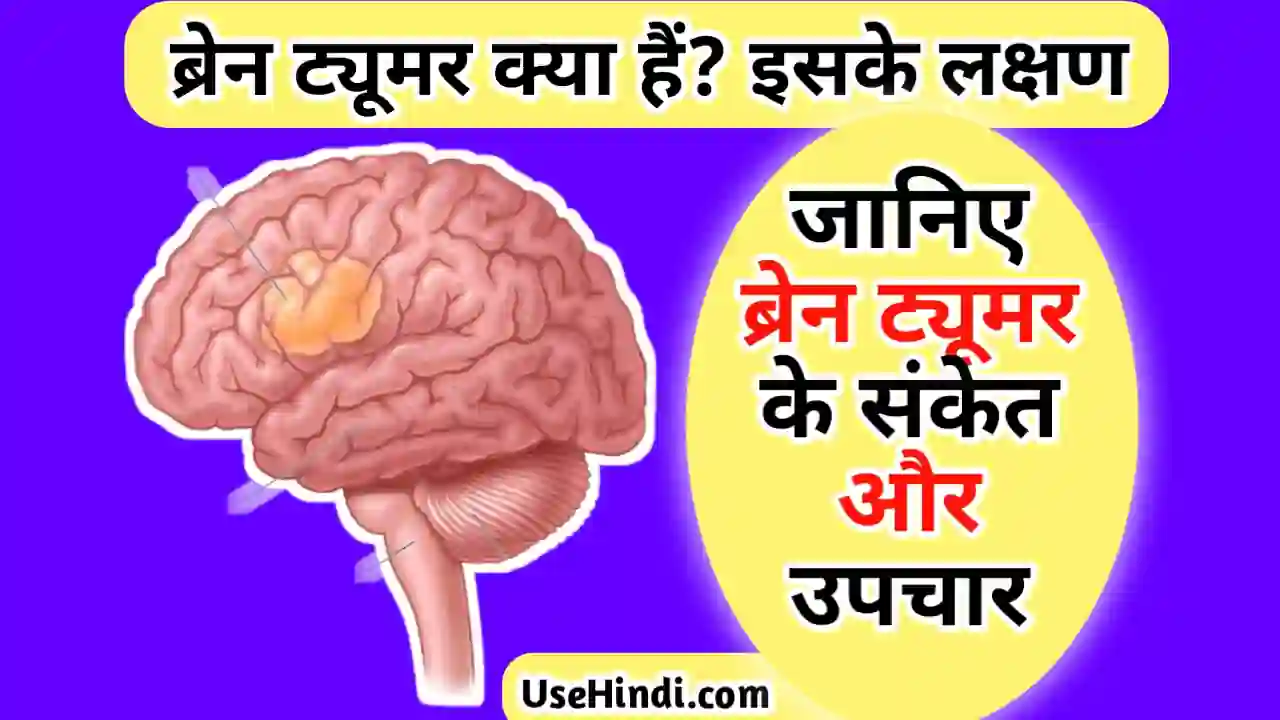 brain tumor symptoms in Hindi